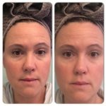 instantly-ageless-for-bags-and-dark-circle-eye-treatments