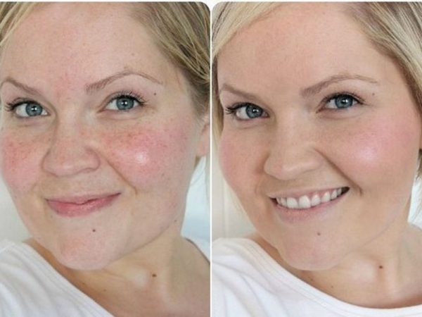 Фото лица до и после применения яичных масок