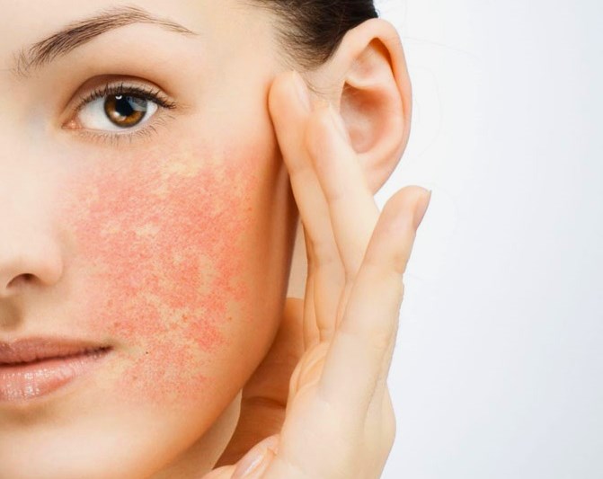 Сухость кожи – причина воспаления и раздражения