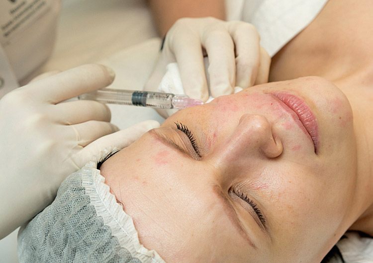 BEAUTYHACK