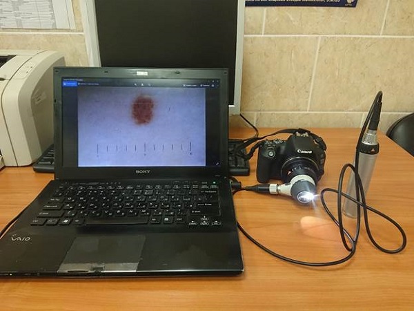 На фото дерматоскоп с фотоаппаратом в сборе