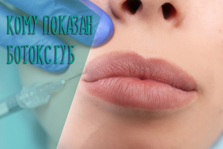 Кому показан ботокс губ – особенности процедуры и противопоказания