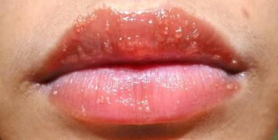 3103608 - Почему губы покрываются сухой коркой