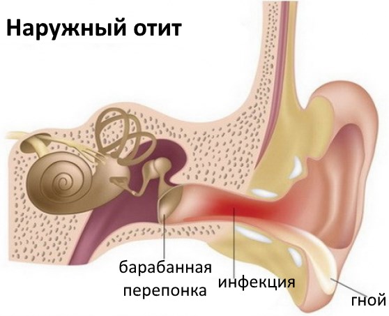 Шелушение и образование корочек в ушах. Причины и лечение перхоти и сухой кожи в ушах