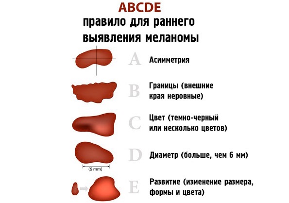 Причины и лечение пятен на коже коричневого цвета: на спине, ногах, руках, животе. Фото