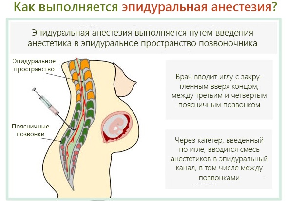 Последствия наркоза на организм женщины после операции, выскабливания, кесарева сечения, в пожилом возрасте