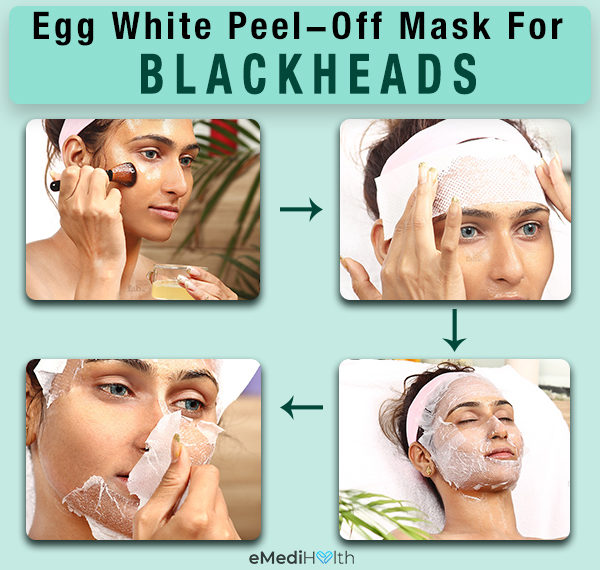 egg white mask for blackheads