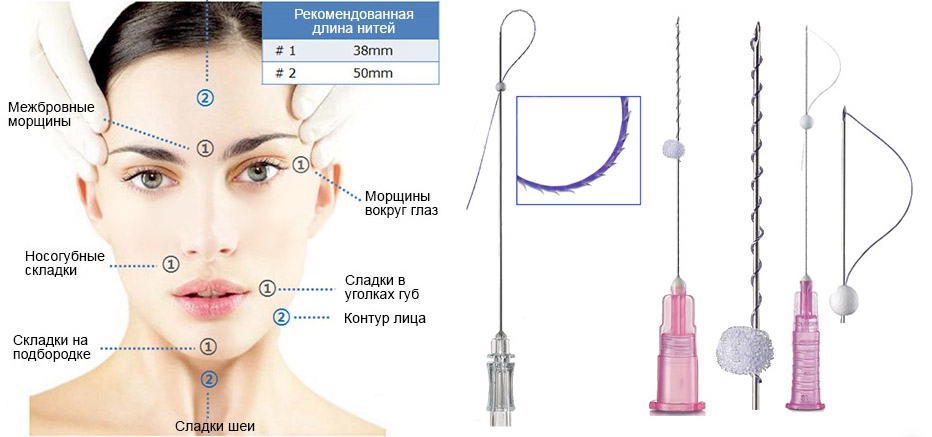 Какие нити подойдут?