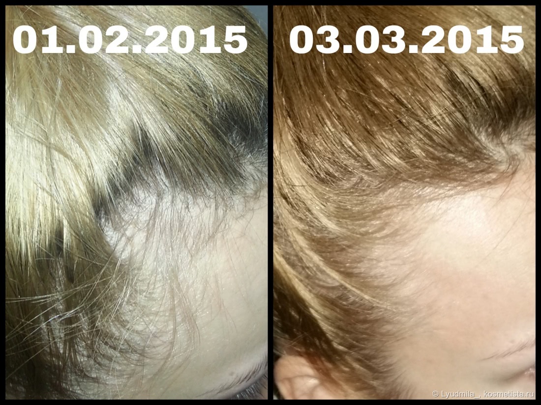 Победа над выпадением волос. Мой опыт с Brahmi Hair Oil от Vadik Herbs