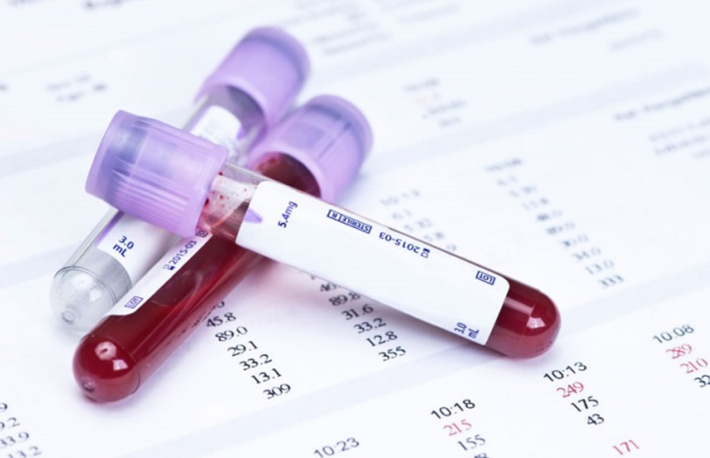 Что определяет анализ крови на ХГЧ и как его сдавать?