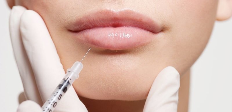 Инъекция гиалуроновой кислоты в губы