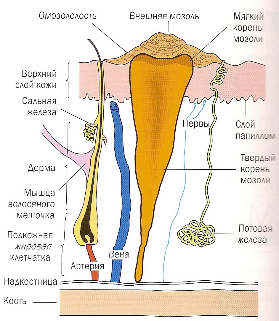 Стержневая мозоль на пальце и мизинце ноги: как избавиться, лечение, мази, фото