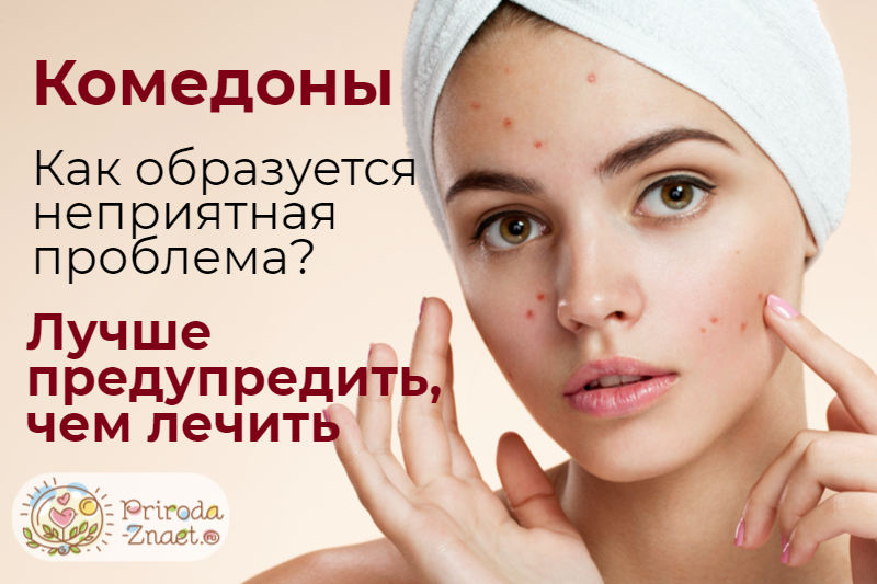 Комедоны на лице