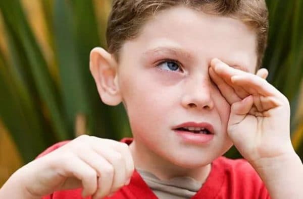 Аллергия воркуг глаз у ребенка