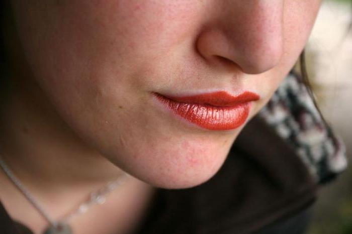 дерматоз на лице