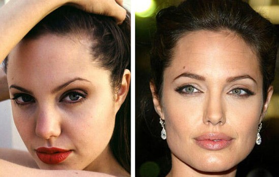 Звезды до и после пластических операций: Анджелина Джоли