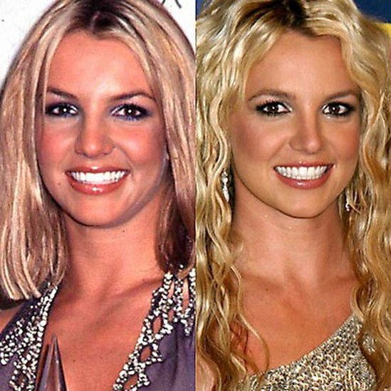 Звезды до и после пластических операций: Бритни Спирс