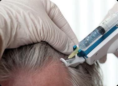мезотерапия для роста волос отзывы 