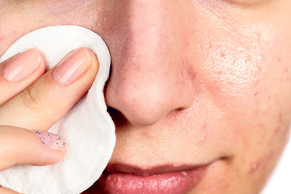 Нужно ли избавляться от жирности кожи носа и как это убрать быстро?